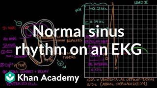 Normal sinus rhythm on an EKG  Circulatory System and Disease  NCLEXRN  Khan Academy [upl. by Gnaw750]